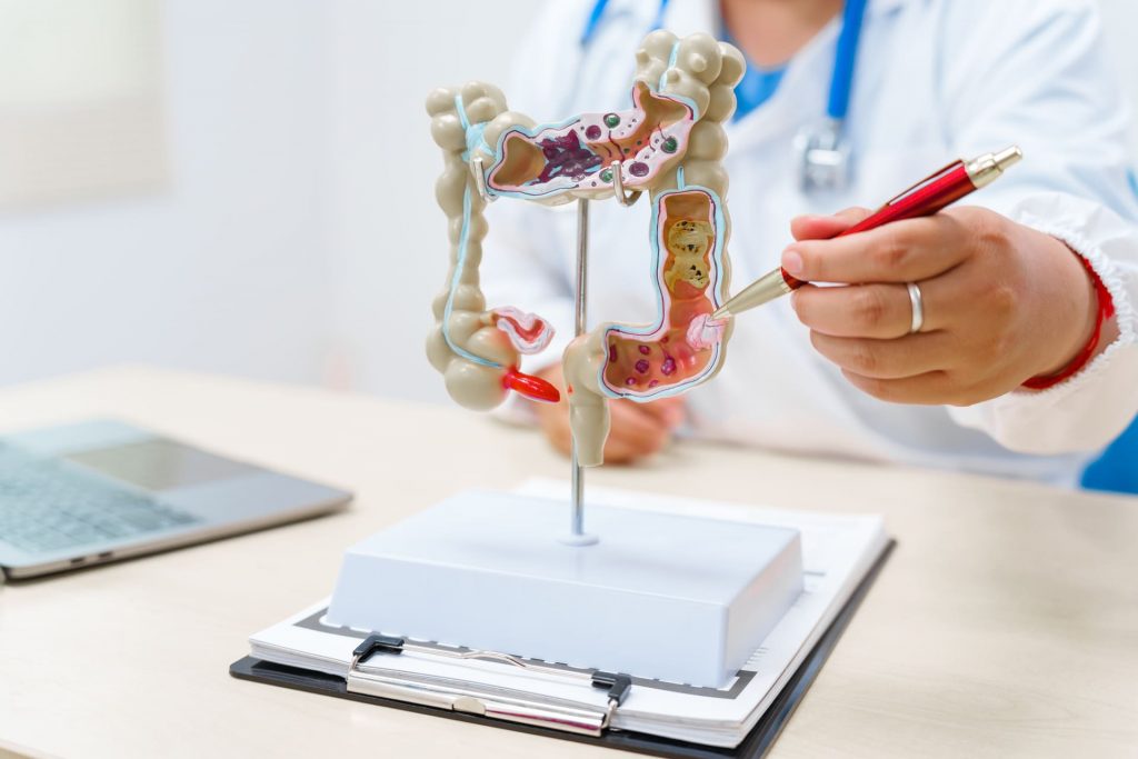 Gut Screening – Ανάλυση Εντέρου & Μικροβιώματος | Mediforma Αθήνα