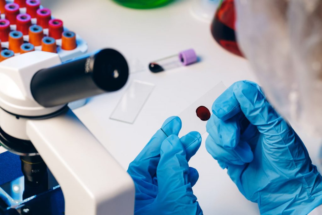 Εξέταση Αίματος για Test Μεταβολικής Οδού | Mediforma Αθήνα